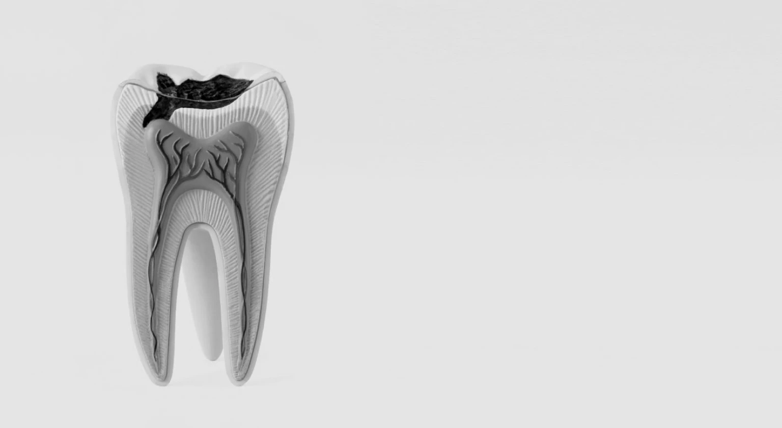 ¡10 preguntas sobre las caries dentales!